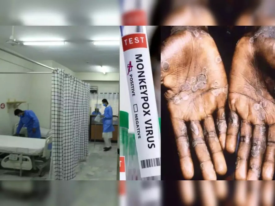 Thailand reports first case of new Mpox strain: A test for healthcare post-COVID